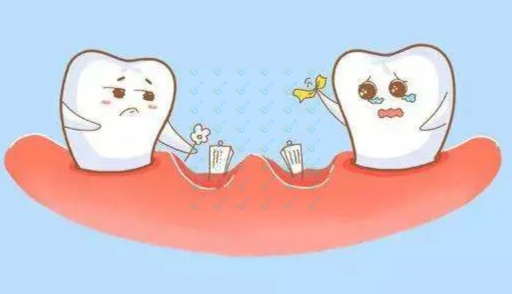 为什么每天都认真刷牙，还是得“龋齿”了呢？龋齿是怎么形成的？