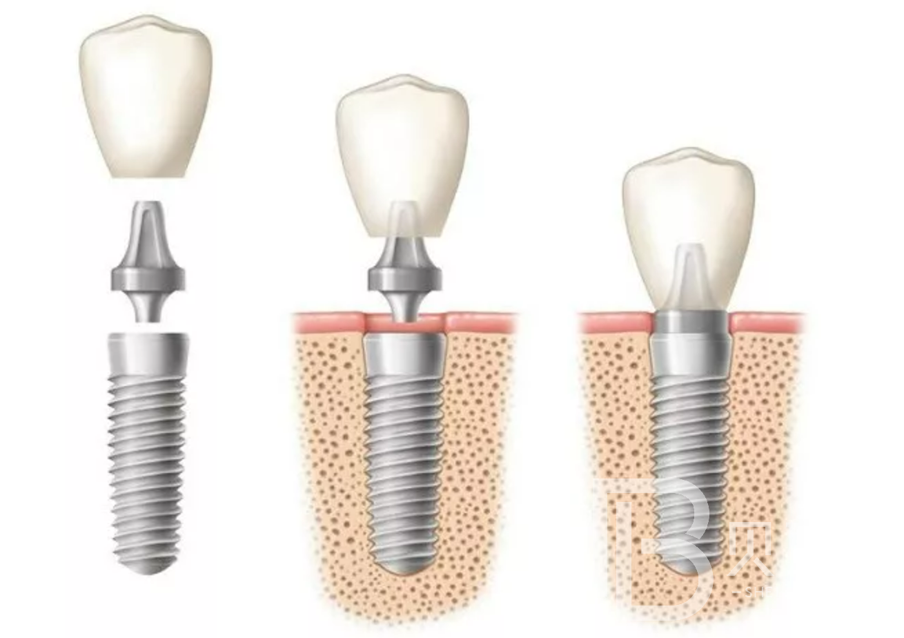 1644800929182549.png ~_8OHOI2L(UFJA05_GOI0YG.png