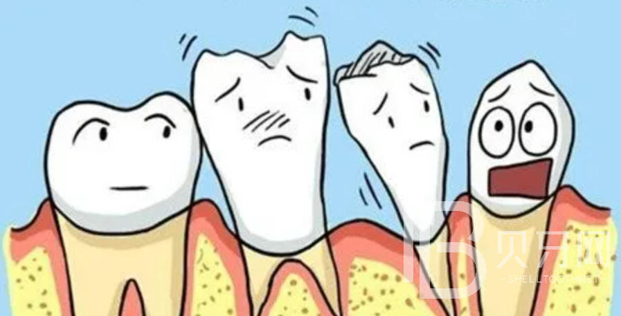 牙龈萎缩怎么办？有什么办法治疗？