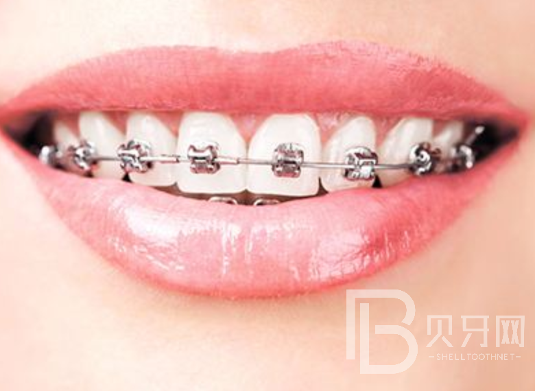 1645084171147687.png 121.png