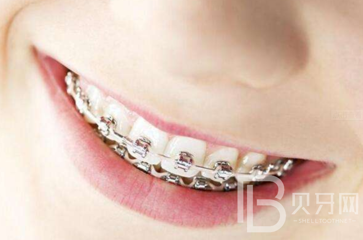 1645089799281379.png 33.png