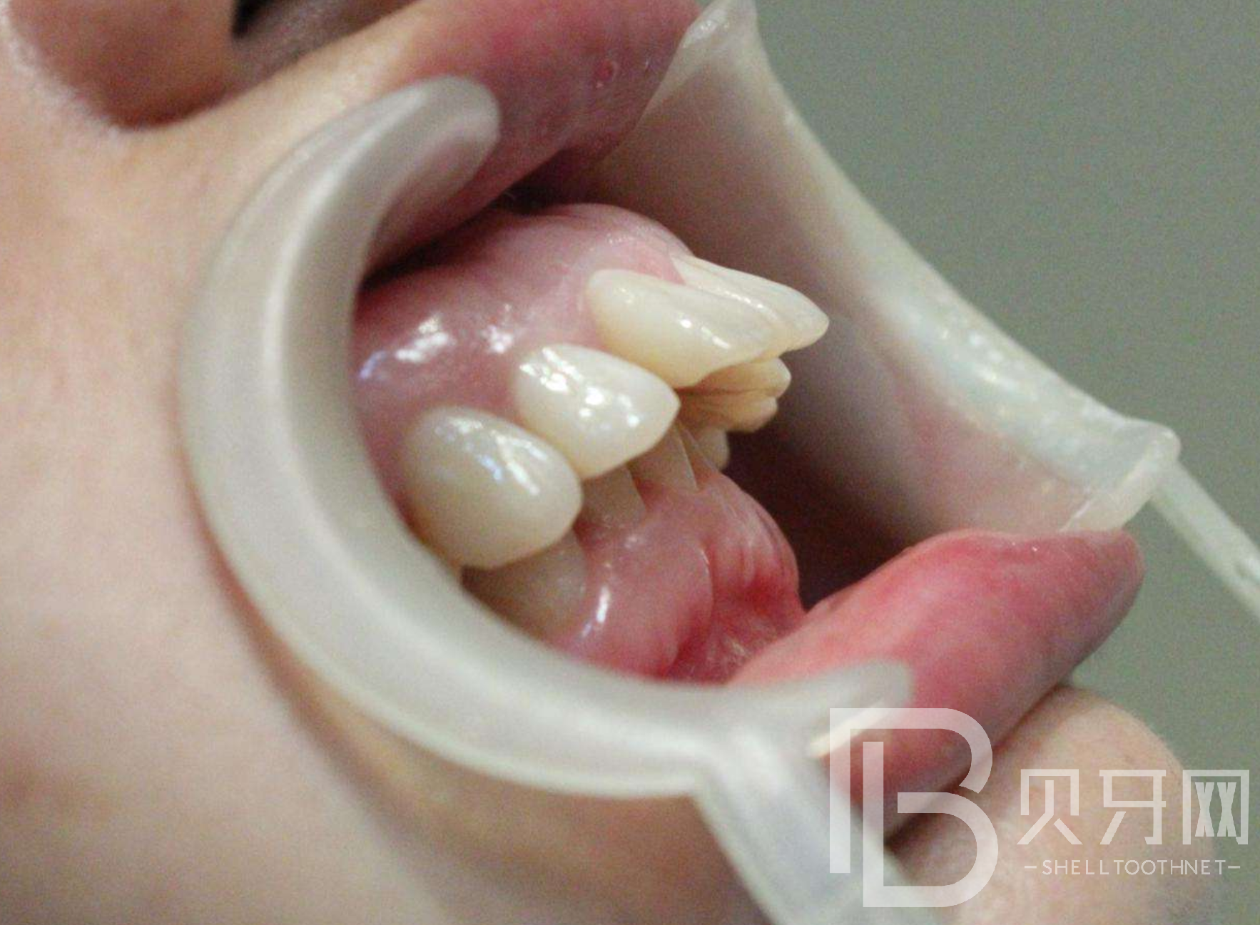 关于牙齿健康的4个秘密，你知道几个？