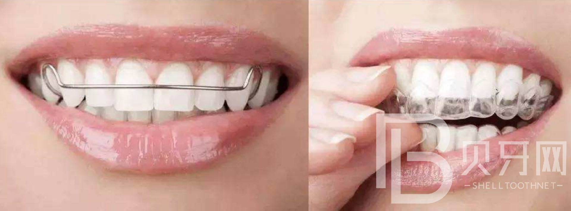 1645322368868944.png I)D7LO~M2$I(UCK$RWD4F(P.png