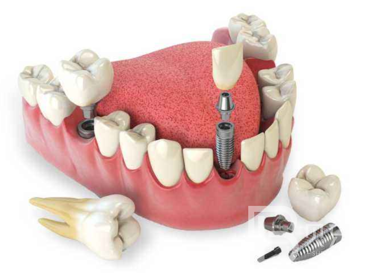 1645345880205663.png 1111.png