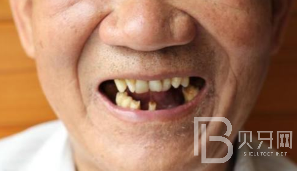 1645345916157164.png 2222.png