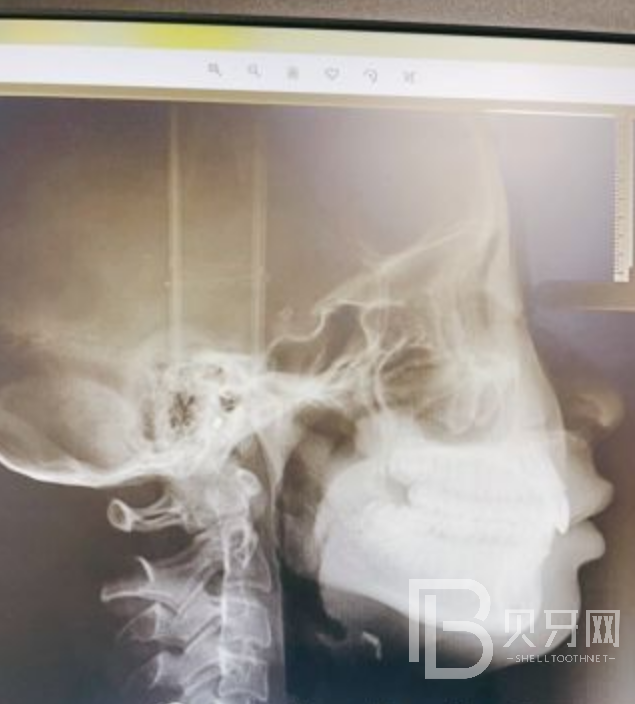 1645663500375813.png %UVW@%6WC5VA26%[97Q5VOR.png