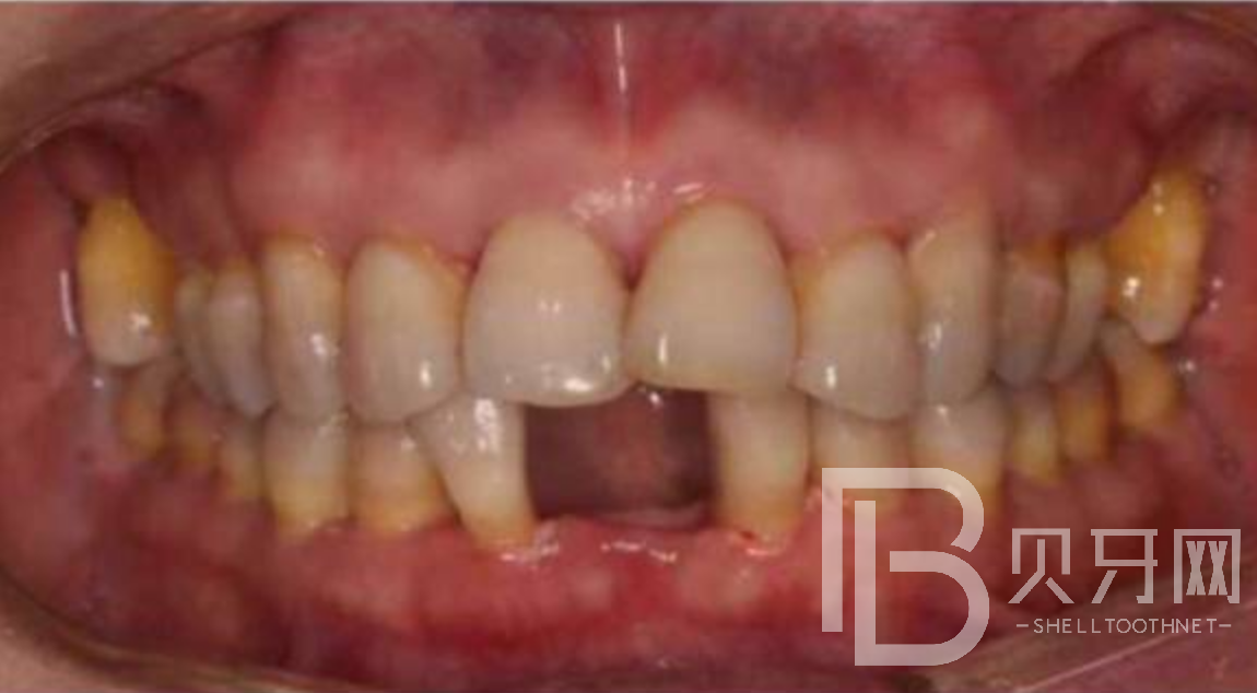 1645669692891148.png $$O~JV[U[LI68Y4CXCQJ9[Q.png