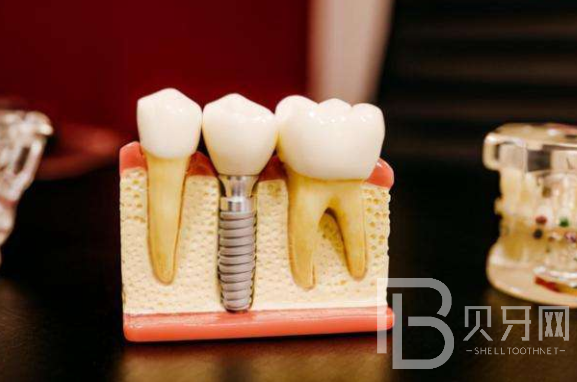 1645857828210777.png 000.png