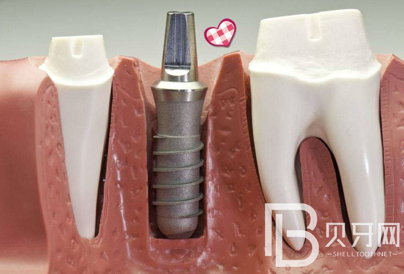 1645862006237134.png 999.png