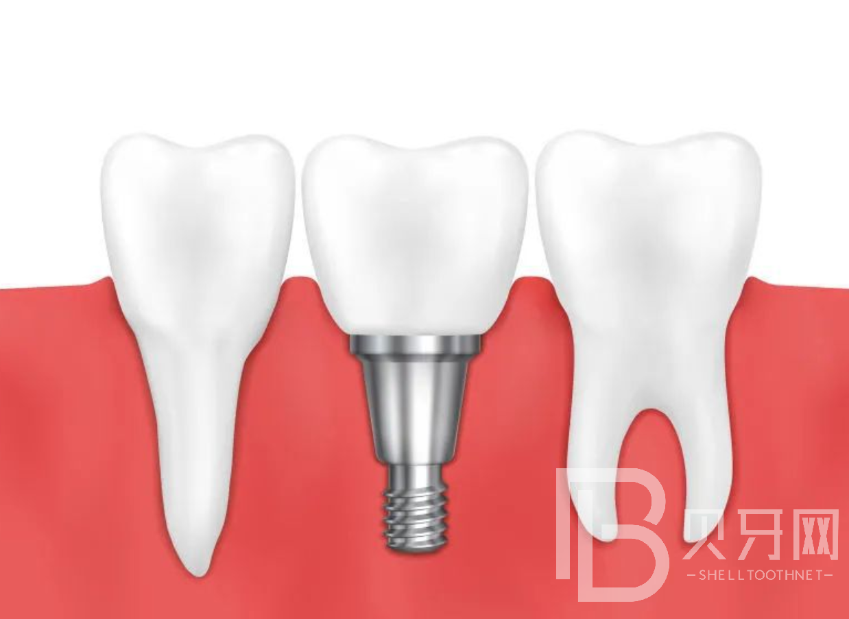 种植牙手术并发症有哪些？