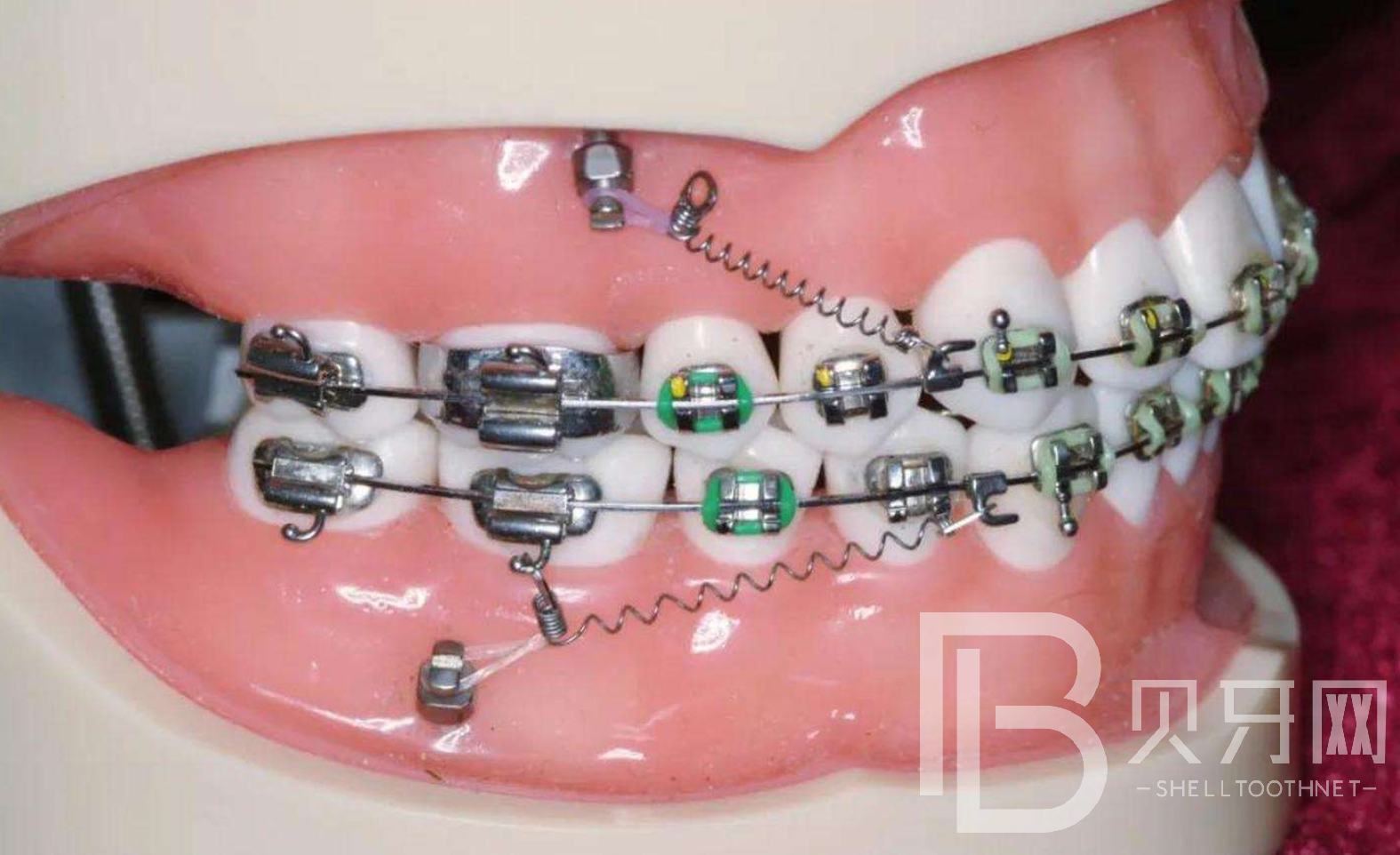 1646214781210824.png 123.png