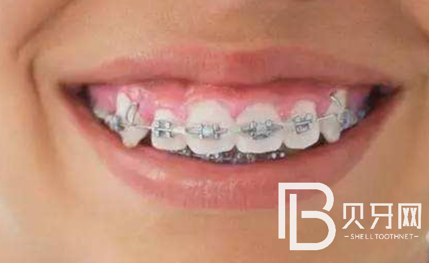 1646301260150075.png 9999.png