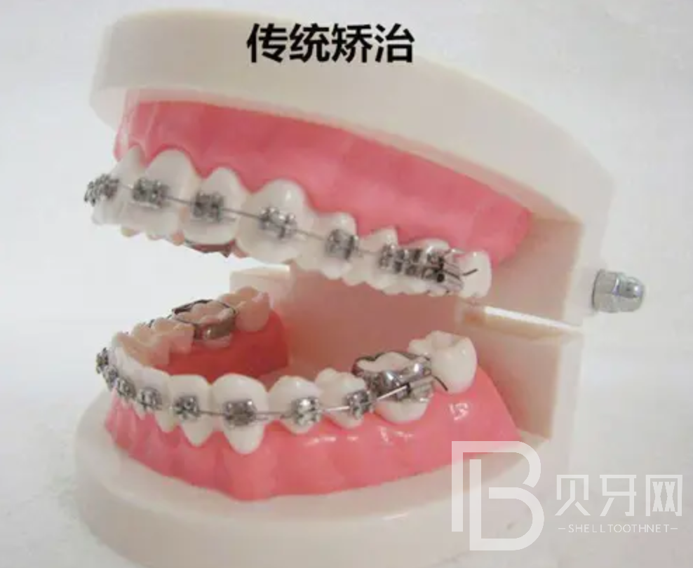 1648371511189192.png 888.png