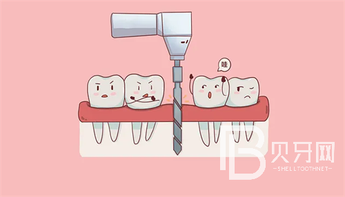 盘点上海口腔排名前十医院!治牙齿找放心医院!
