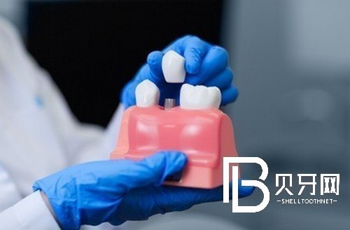 上海雅悦口腔怎么样,听说做种植牙医生技术不错?