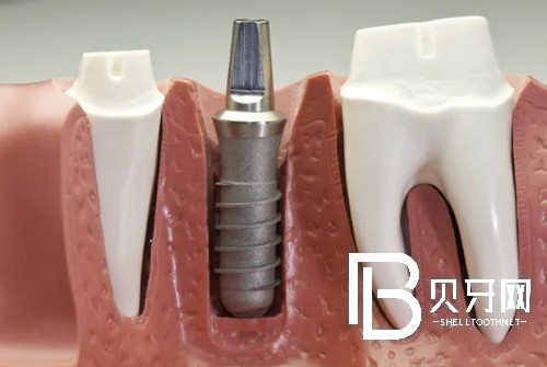 1667288034764561.jpg 截图14464.jpg