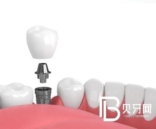 1667312203362008.jpg 截图14470.jpg