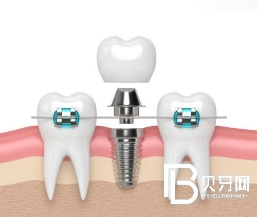 1667312960107938.jpg 截图14467.jpg