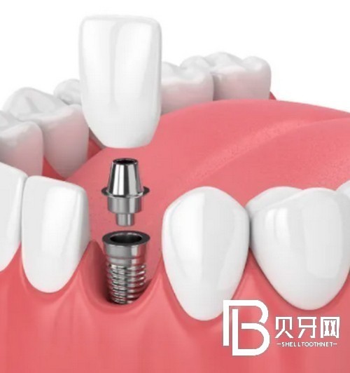 1667351420904865.jpg 截图14469.jpg