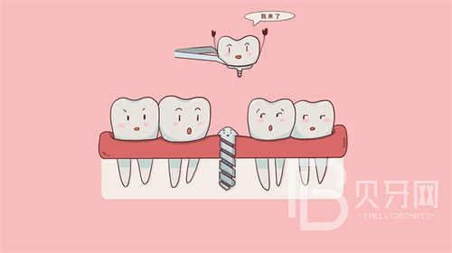 上海华齿口腔做牙收费贵吗?看看诊疗价格这几项很便宜!