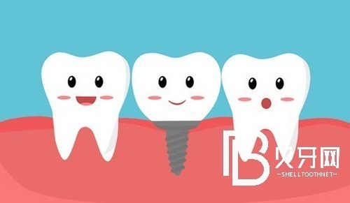 上海黄浦区种植牙价格表,种牙好又便宜的牙科