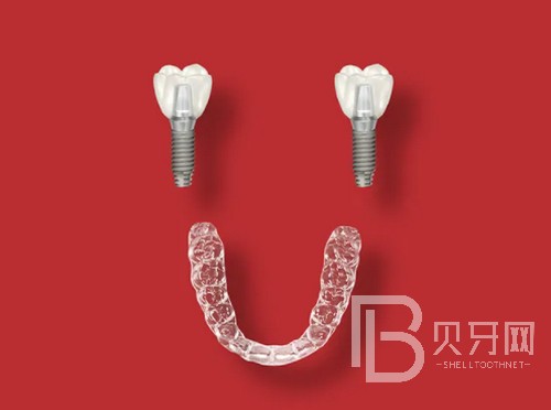 上海成人牙齿矫正大概价格多少钱,费用价格都是怎么算的