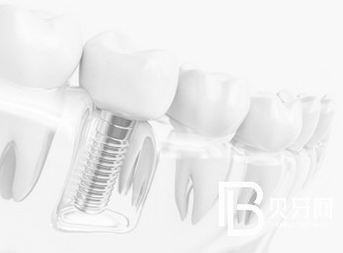 盘点北京牙齿矫正好口碑医院,这几家值得一去!