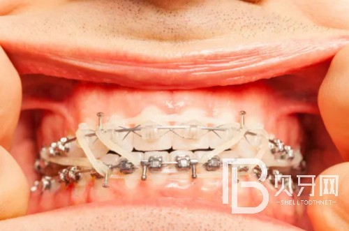 1667527988104698.jpg 截图14474.jpg