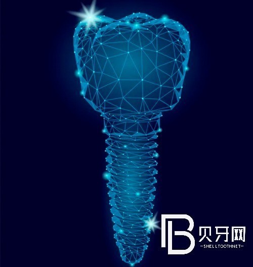 上海拜博口腔种植牙价目表,包含韩国,瑞士种植系统价格