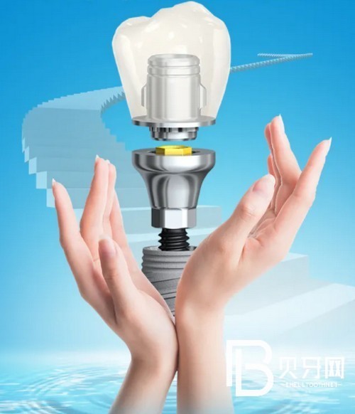 北京中诺口腔医院正规吗?中诺口腔医院种植牙怎么样?