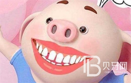 上海圣贝口腔牙齿矫正怎么样?真实牙友口碑揭秘!