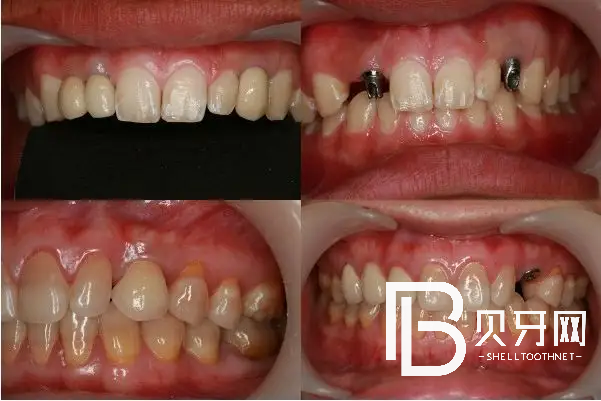 1668388414952717.png 微信图片_20221114091321.png