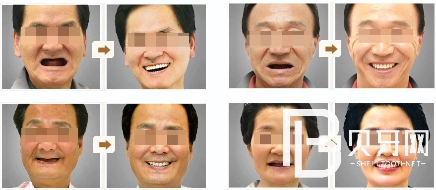 1669114304212026.jpg 0264b362e04616ed2170b4ce8381b2a9_cgal01.jpg