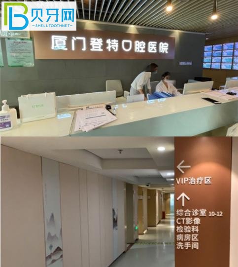 登特牙齿不到半个小时就搞定了,你知道吗?