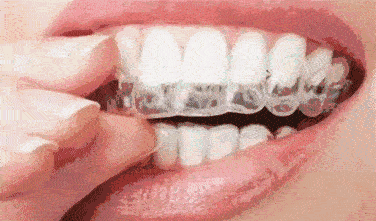 北京中诺口腔医院种植牙技术好的医院,好口碑不是空穴来风