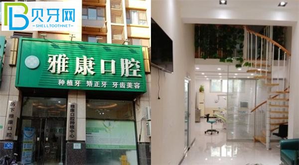 济南雅康口腔种植牙好吗