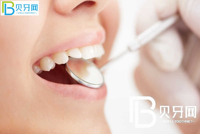 1669197890104336.jpg a91ad8f9da5f32a26375f2febc0c4faf_l16ox3LhHG_small.jpg