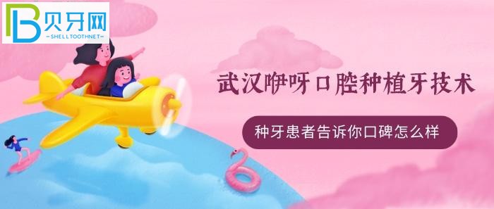 All-on-4/6种植牙技术好不好？(组图)