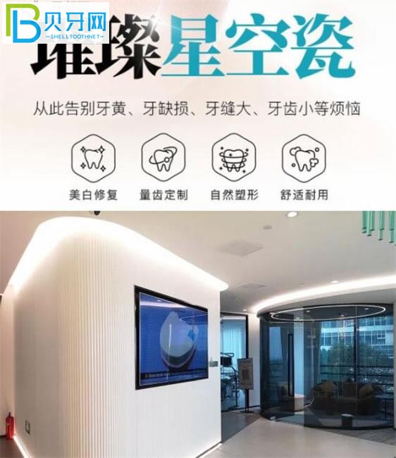 厦门优梨口腔瓷贴面价格