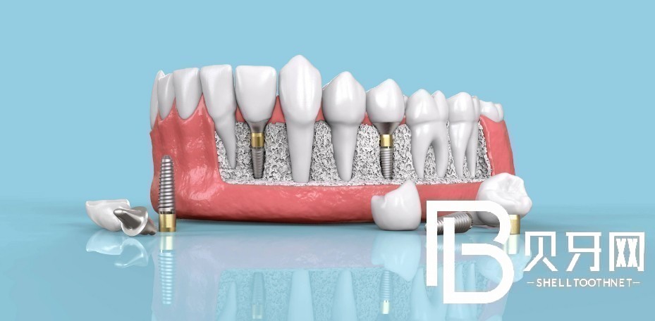 1669780888700486.jpg 12.jpg