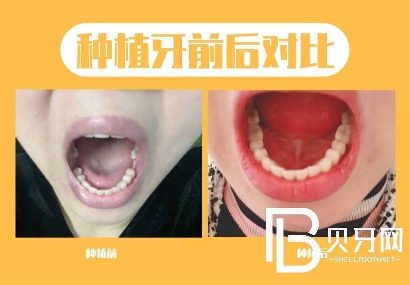 1669955225117513.jpg 微信图片_20221202122642.jpg