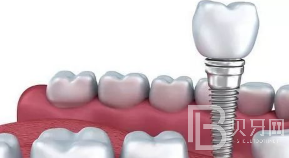 1670127459116579.png image.png