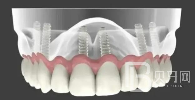 1670208594389159.jpg H{2Y21S87O02H2NWU}K16TT(1).jpg