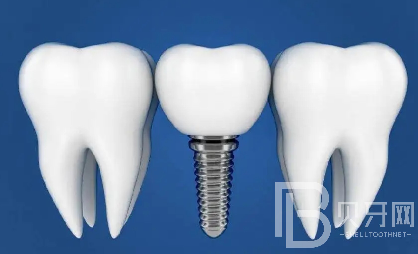 1670227470204497.jpg @A5$~_T(M6GS~Y{JY`%HTI8.jpg