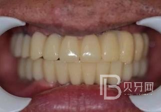 1670294551175084.jpg 85a8ab632a244c0fbff48c218012f5b6(1).jpg