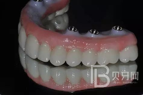 1670461925128263.jpg 1000.jpg