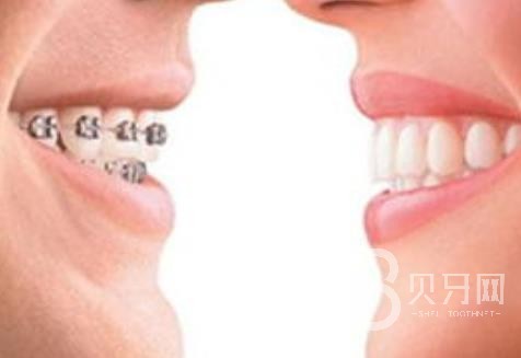 广州欧立口腔怎么样?广州欧立口腔口碑好不好?广州欧立口腔种植牙价格