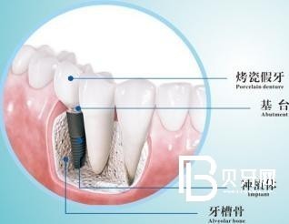 牙齿缺失对脸有影响吗？北京西尔口腔(双井分院)怎么样？