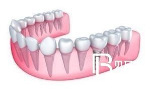北京牙齿缺失修复方法哪些？北京优贝口腔门诊部(南环店)怎么样？